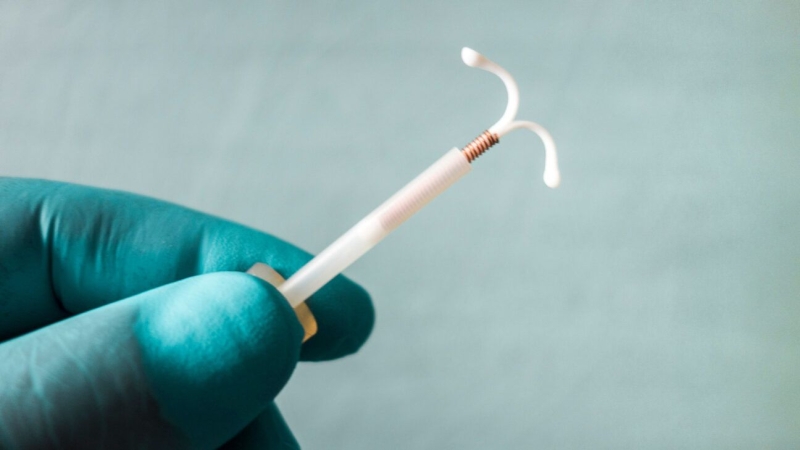 CDC Updates Recommendations for IUD Pain Management